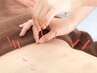 【肩や腰、身体の悩みに鍼灸施術】　新規限定　500円OFF1600円