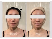 つかしんえいど/【エステ】スペシャルコルギ