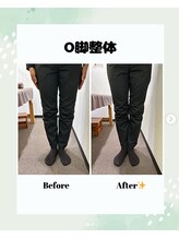 鶴見わだち整骨院/O脚改善ビフォーアフター