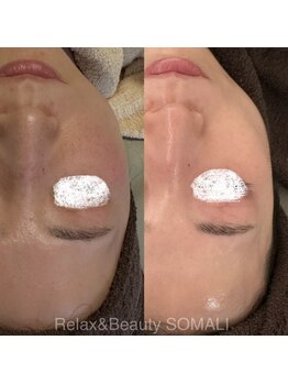 ソマリ(SOMALI)/大切な挙式前の艶肌仕上げ