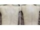エト(eto.)の写真/背中ニキビケア、毛穴ケア、敏感肌にお悩みの方をハーブピーリングで改善に導く肌質改善特化サロン◎