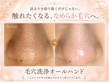 ウー 上熊本(WOO)/【毛穴黒ずみ】毛穴洗浄