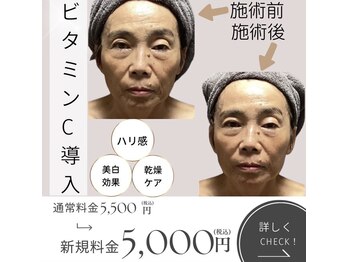 きれい塾 恵比寿/ビタミンC導入