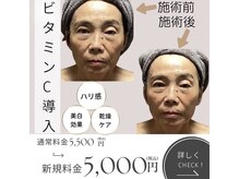 きれい塾 恵比寿/ビタミンC導入