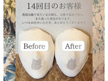 カンコルギセラピー 広島幟町店(KAN)の雰囲気（お顔の下半身がスッキリ！余白が少なくなると小顔効果◎）
