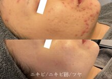 トップスキン 渋谷(TOPSKIN)