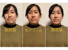 リラクゼーションカイロ ふくろう/◆3月から始まる小顔・整顔調整