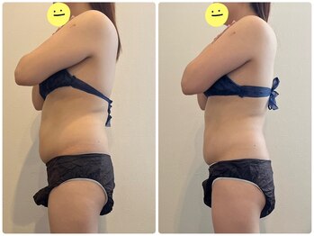 鈴木整体院 仙台泉院/小顔造顔/骨盤矯正/痩身整体