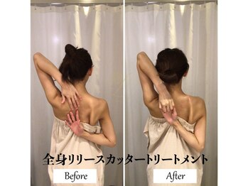 リノ(Lino)/全身リリースカッターB&A