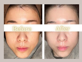 ハル(HARU.)/加工フィルター不要の透明感!