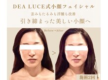 デアルーチェ(DEA LUCE)の雰囲気（小顔フェイシャル/鎖骨矯正/肩こり解消/デコルテケア/毛穴/美肌）