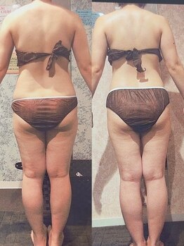 パーフェクトボディプレミアム 大阪梅田店(PERFECT BODY PREMIUM)/お客様　ビフォーアフター（33）