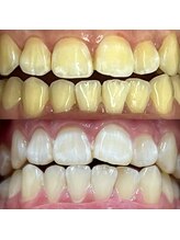 イイハキューブ(e8 cube)/before & after