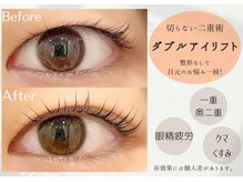 ミーカラー(me calla)の雰囲気（整形なしで二重に導く新技法【ダブルアイリフト】二重幅改善にも）