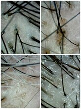 エスカペリ(s_capelli)/様々な頭皮・毛髪悩みに対応