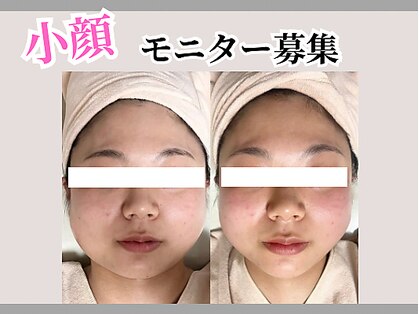ビースリー(b3)の写真
