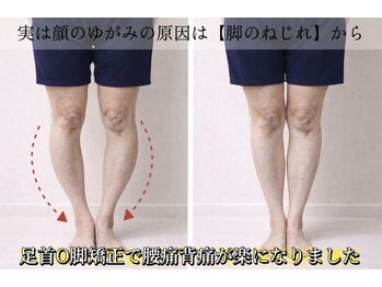 サロンチオリ 烏丸(Salon Chiori)/顔の歪みの原因は【脚のねじれ】