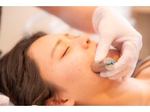 北千住整骨院の雰囲気(最新美容鍼【ダーマ鍼】毛穴、くすみ、肌質改善に有効)