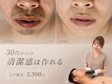 フォー(the 4)