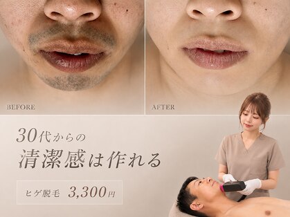 フォー(the 4)の写真