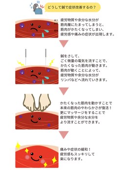 鍼灸整骨院スセリ(Suseri)/筋肉