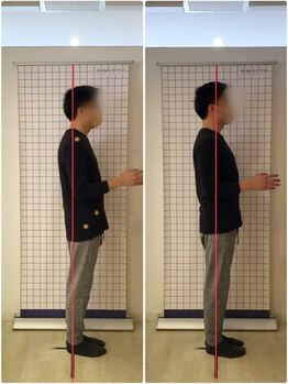 越谷KAJI整体院/肩こり、姿勢改善