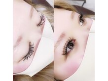 エモーション 境店(emotion)/バインドロック