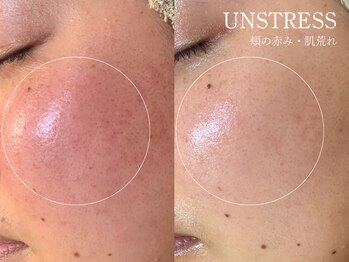 クレスト(CLEST.)/クリスティーナ　アンストレス