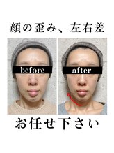 キュープ 相模原淵野辺店(Qpu)/たった4回で人生で1番小さな顔に