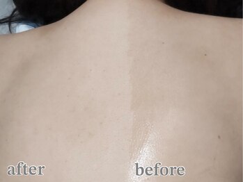 ステイ(STAY)/シェービングで肌トーンup！