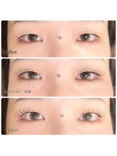 ニーチェ アイ(niche eye)/エクパ