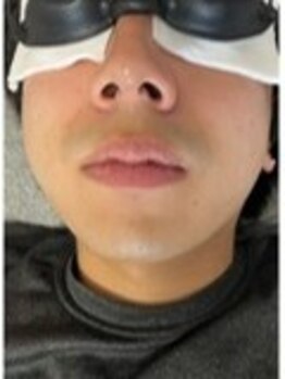 フォーグッド(forgood)の写真/ビジネスマンの方必見！《鼻毛/耳/眉》の脱毛ができるサロンなので清潔感のある男性へ♪敏感肌の方にも◎
