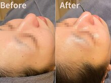 グレース 吉祥寺(grace)/ざらつきオフ！クレイパック