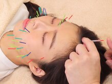 つつじが丘整骨院鍼灸マッサージ院の雰囲気（豊富な美容鍼メニューからお悩みに沿ったご提案を致します！）