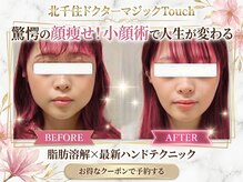 ドクターマジックタッチ(Dr.MAGIC TOUCH)