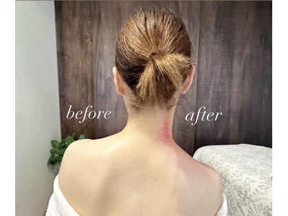 リュクス(Luxe)の写真