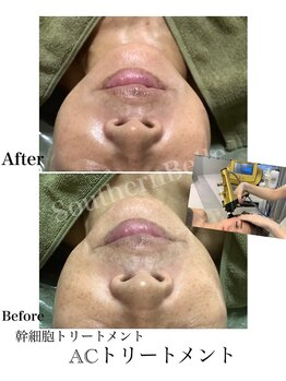 サザンベル 那覇店(Southern Belle)/