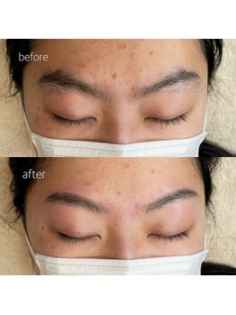 ネネ(nene.)/eyebrow styling