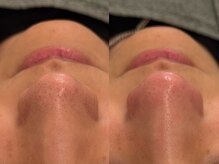 アルテ 神戸(Arte)の雰囲気（毛穴洗浄エステ）