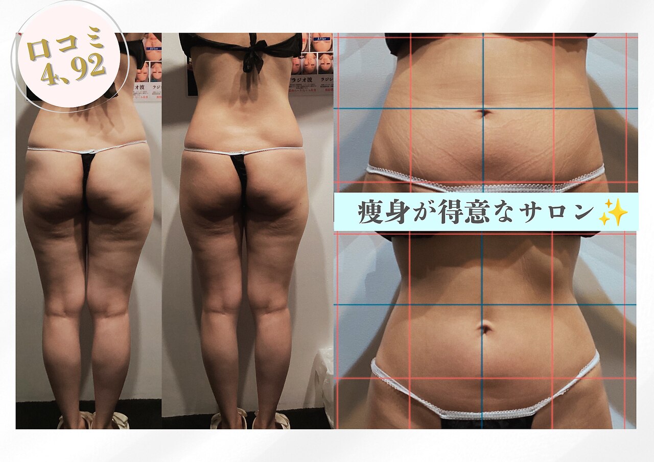 ラジオ波 キャビテーション 大阪市に関するサロン Beauty salon Lino