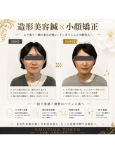 エモシオン トウキョウ(EMOTION TOKYO)/造形美容鍼×小顔矯正