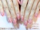 全てにこだわった施術！！