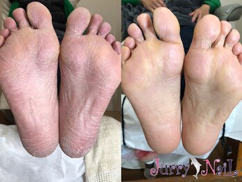 ジュリーネイル 所沢店/足裏角質ケア　
