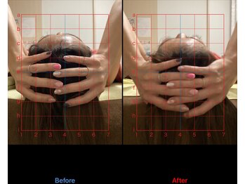 ミ スク 美蓬/美脳ヘッドスパ効果