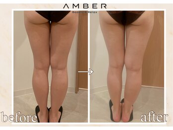 アンバー 恵比寿(AMBER)/美脚になりたい
