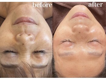 ラメール(la mer)/痩身/眉毛/エステ/フェイシャル