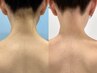 女性人気♪ワックス脱毛と光脱毛の同時脱毛【うなじ&背中】通常17000→￥8000