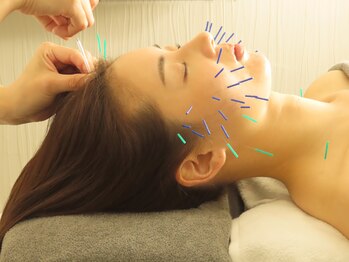 和ら/鍼灸小顔矯正で秒速リフトアップ