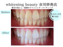 ホワイトニングビューティー 市川妙典店