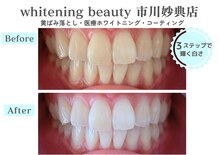 ホワイトニングビューティー 市川妙典店